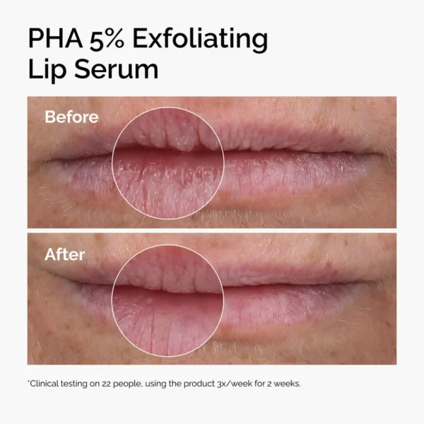 lip-exfoliating-serum-15ml-3 The Ordinary PHA 5% Exfoliating Lip Serum